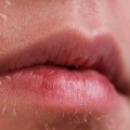 Dry Skin: Everything You Need to Know